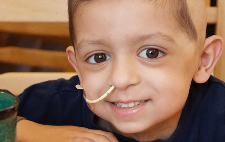 A close-up image of a young boy wearing a dark blue t-shirt and smiling at the camera while resting his hands on a table. He has a nasal feeding tube running across the left side of his face into his nose.